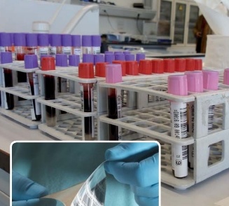 etiquetas autocolantes tubos de sangue
